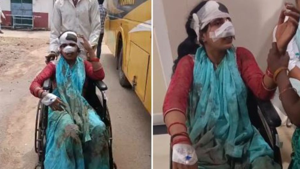 Hardoi: घर में खूनी खेल! पति ने काटी नाक, गुस्से में पत्नी ने काट दिया प्राइवेट पार्ट